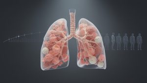 Lire la suite à propos de l’article Emphysème pulmonaire : quand et comment cela influence réellement l’espérance de vie