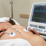 Appareil d’électrocardiogramme enregistrant un tracé cardiaque net grâce à des électrodes correctement positionnées sur la poitrine d’une femme dans une salle médicale.